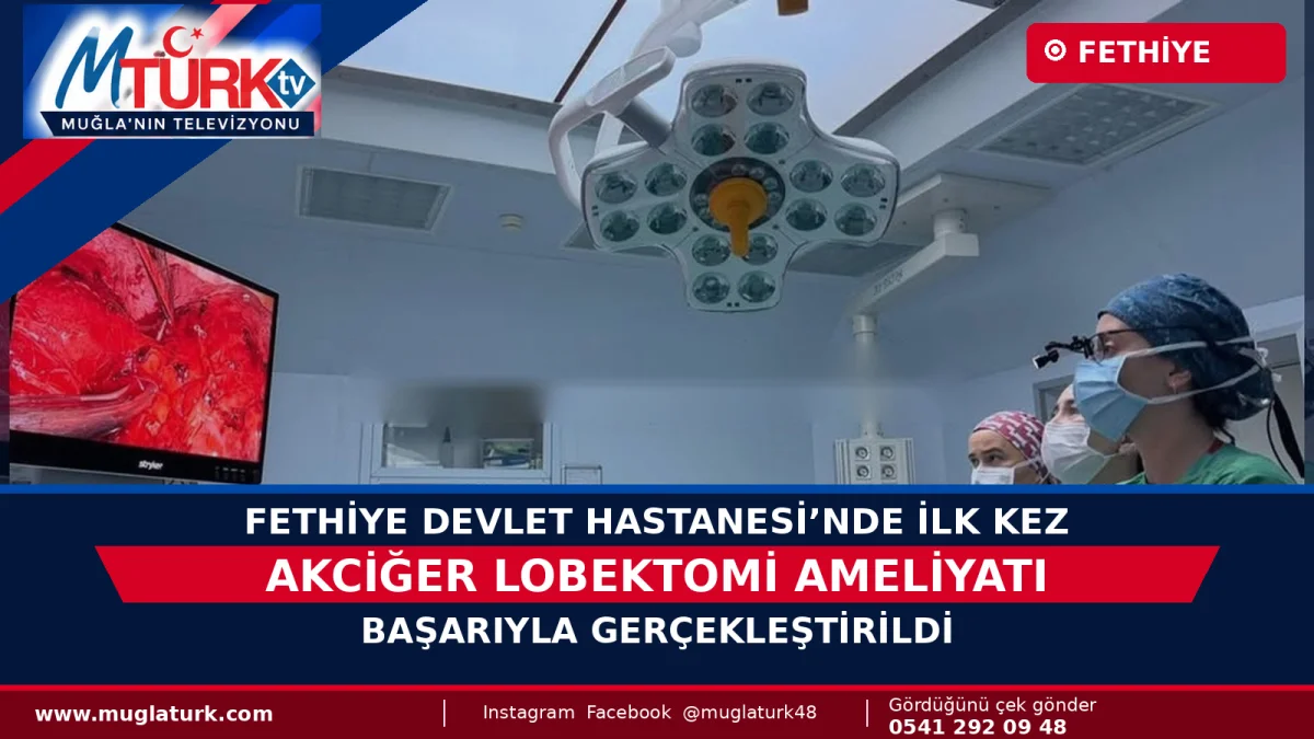 Fethiye Devlet Hastanesi’nde İlk Lobektomi Ameliyatı Yapıldı